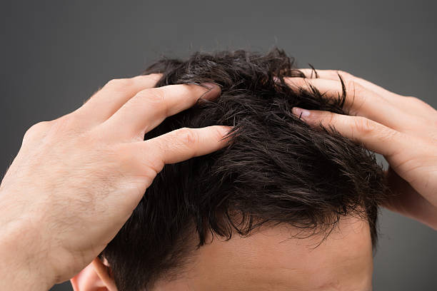 affordable hair growth treatment in chembur affordable hair growth treatment in chembur